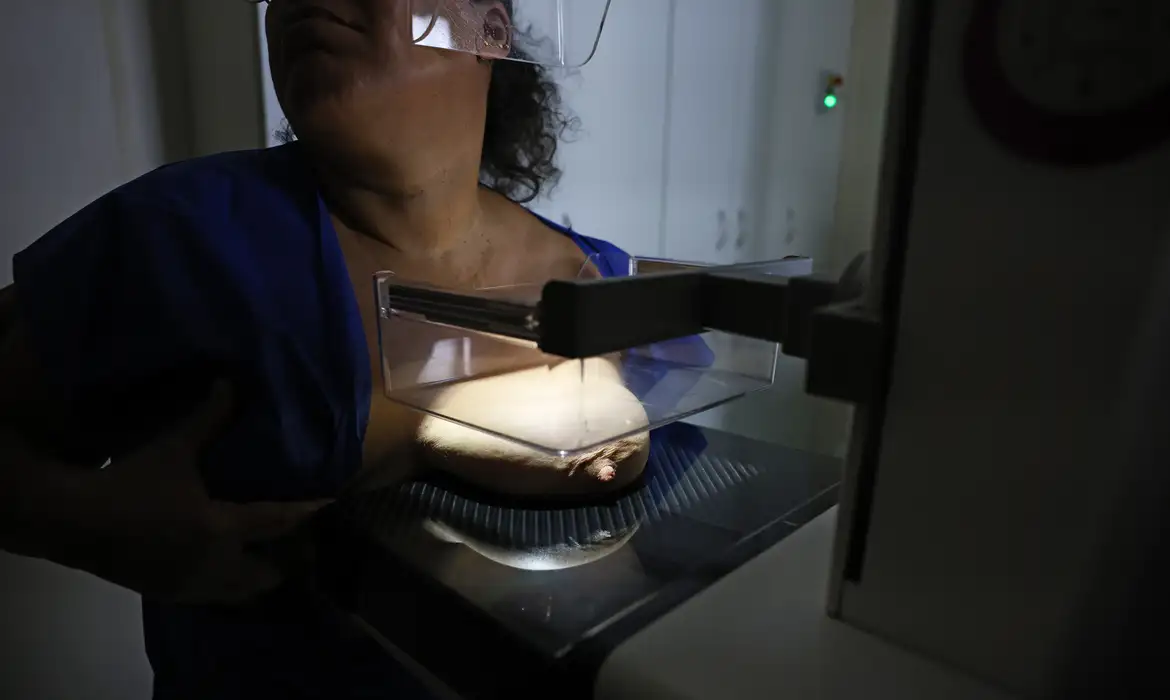 ANS defende que plano cubra mamografia digital sem restrição de idade